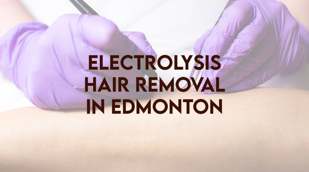 Electrolysis Hair Removal in Edmonton | Redefine Clinic